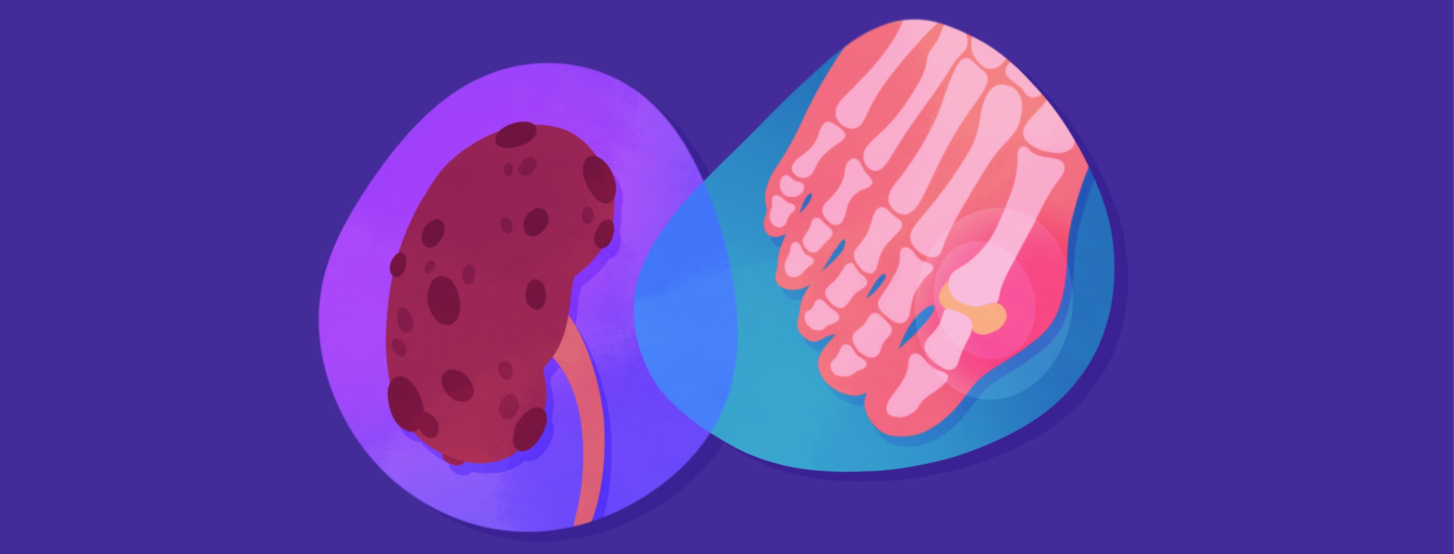 A diseased kidney overlapping with an x-ray of a foot presenting gout in the big toe