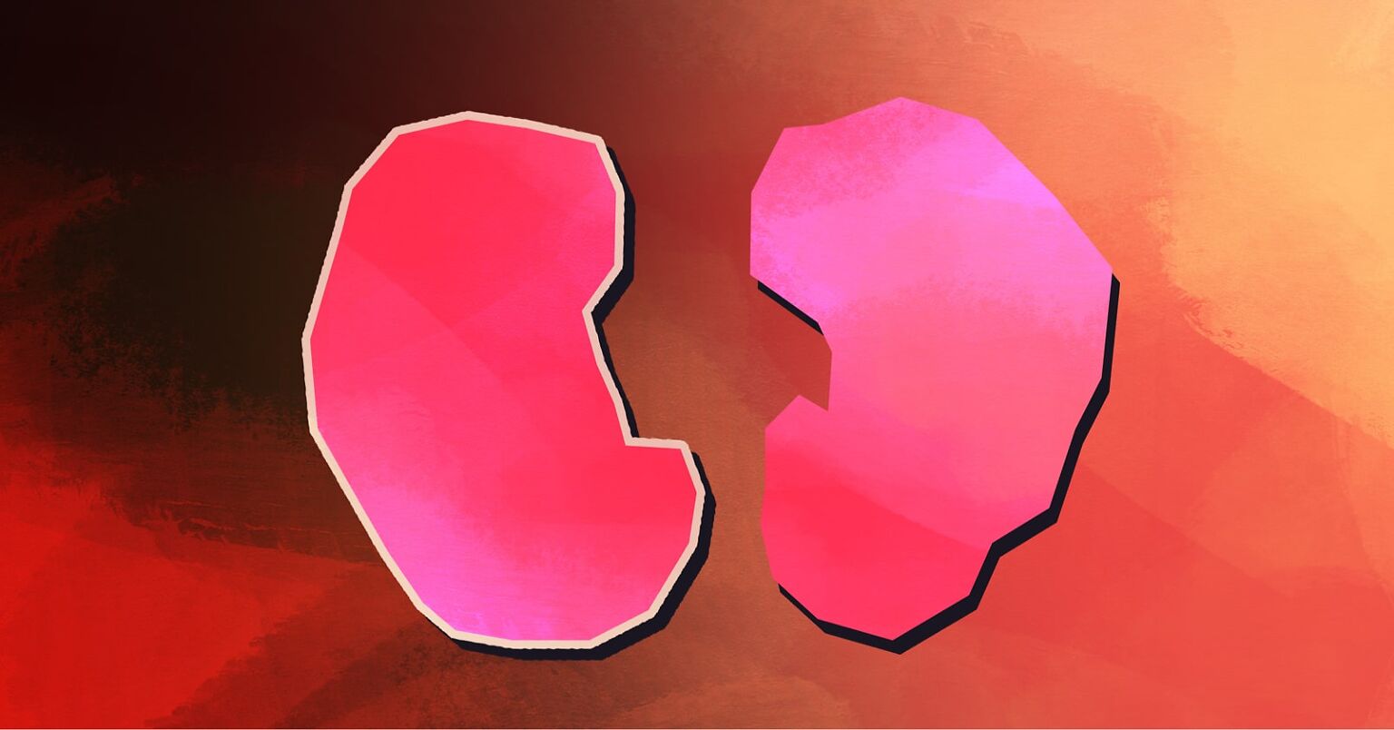 How Contrast Dye Affects Your Kidneys image