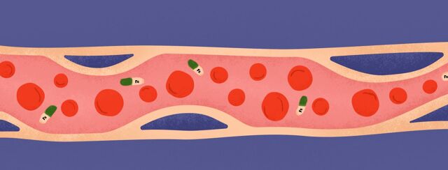 Chronic Kidney Disease and Anemia image