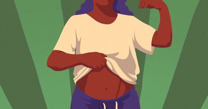 My Kidney Transplant Journey and What I've Learned image