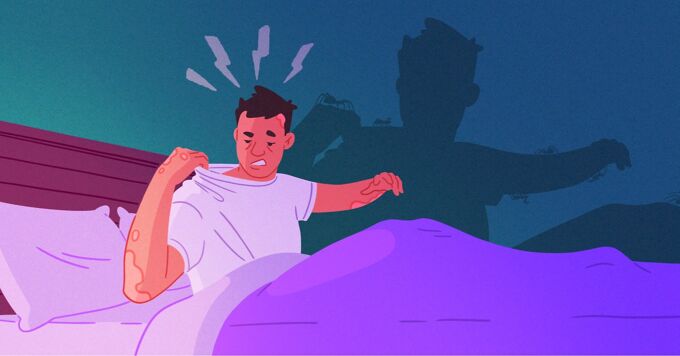 The Cause of the Itch image