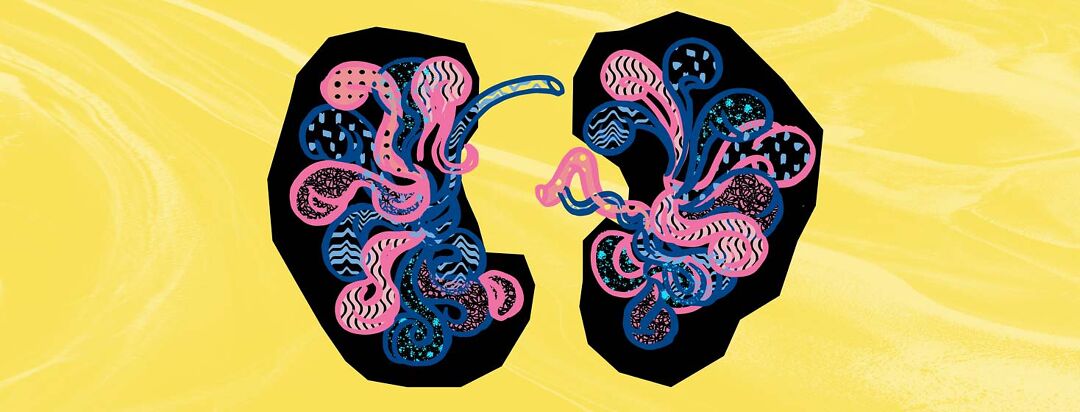 Does a Gene Called APOL1 Affect Your Kidneys? image